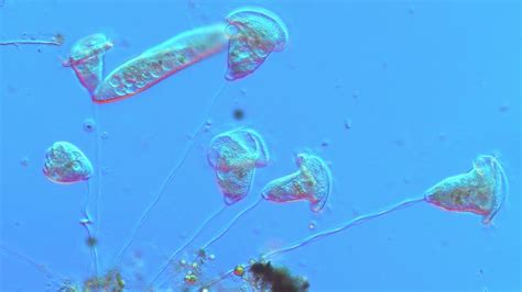  Vorticella! Te Maleńkie Zwiereta Potrafią Tańczyć i Odzyskiwać Się z Każdym Wstrząsem